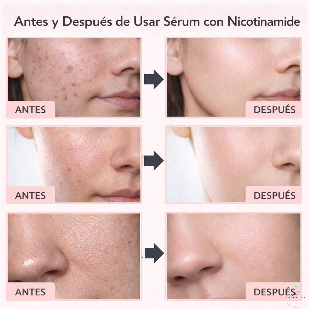 Sérum facial con nicotinamida 50ml | Día y Noche | INCLUYE Sérum Ojeras ¡Gratis!